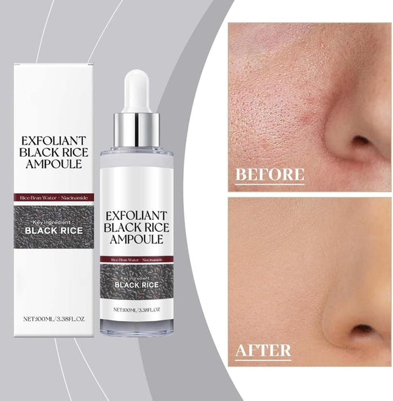 Ampolla Exfoliante Arroz Negro 100ML
