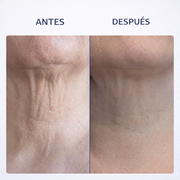 Rodillo 3D antiarrugas cuello y rostro