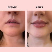 Lipboost Reafirmante Labios natural