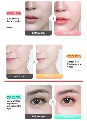 Masajeador facial antiarrugas | ViamoMas