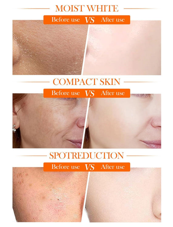 Crema facial vitamina C y niacinamida