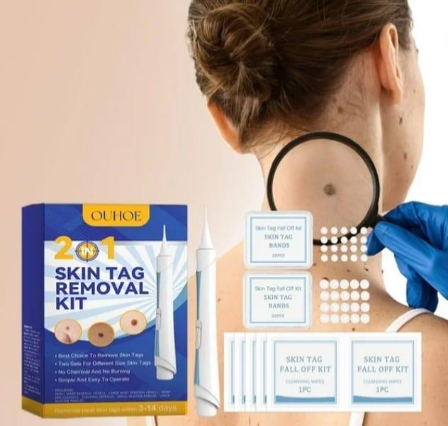 Despídete de los skin tags