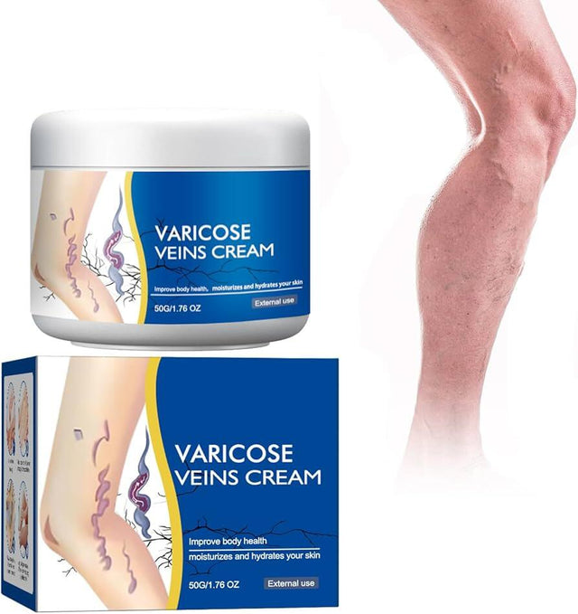 Crema para Piernas con Varices | ViamoMas