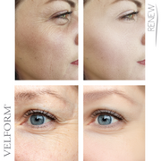 Tratamiento facial antiaging con colágeno