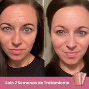 Mascarillas Biocolágeno 5 uds | ViamoMas