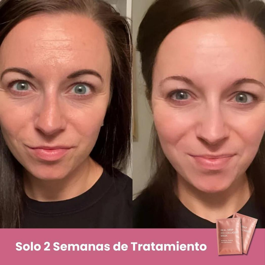 Mascarillas Biocolágeno 5 uds | ViamoMas