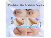 Masajeador facial lifting EMS- Dispositivo Facial de Limpieza con 3 Luces LED