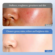 Crema facial con niacinamida y arroz