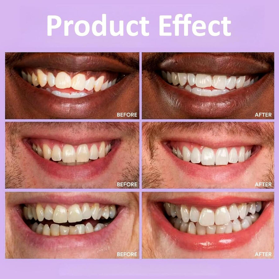 Tiras Blanqueadoras Dientes en Casa