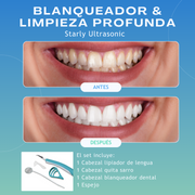 Limpiador dental alta frecuencia | ViamoMas