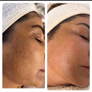 Crema coreana niacinamida y ácido hialurónico