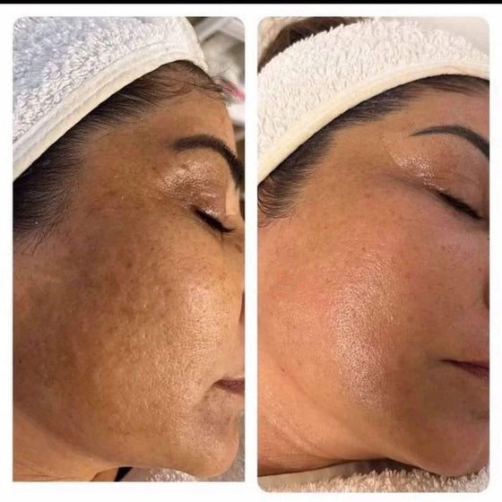 Crema coreana niacinamida y ácido hialurónico