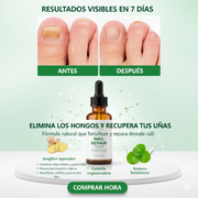 Spray antihongos para uñas 30ml natural