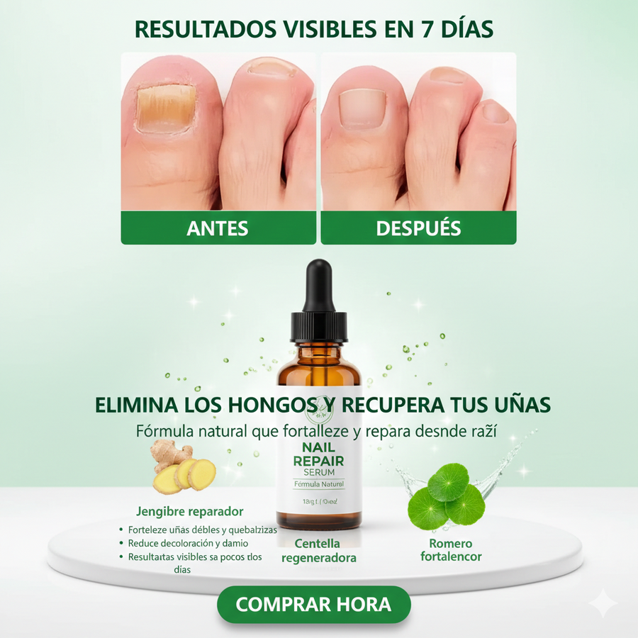 Spray antihongos para uñas 30ml natural