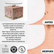 Parches para verrugas sin dolor | ViamoMas