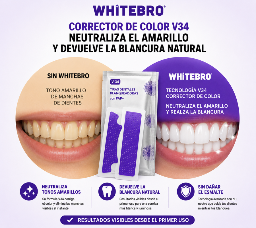 Tiras Blanqueadoras Dentales V34 | 14 uds
