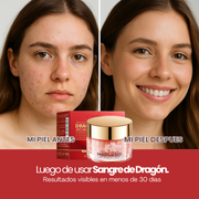 Crema Sangre de Dragón para la piel