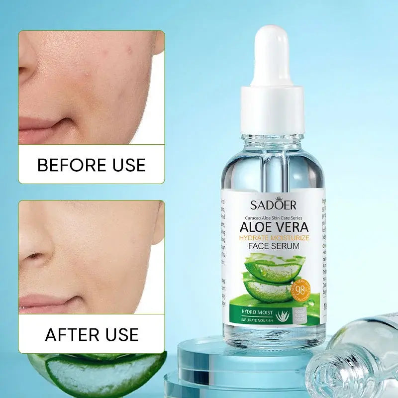 Esencia facial aloe vera natural | ViamoMas