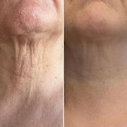 Masajeador antiarrugas cuello y rostro 3D