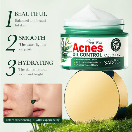 Crema acné árbol de té SADOER 50ml
